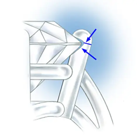 GIA illustration of an overcut prong and an open gap at the bearing.